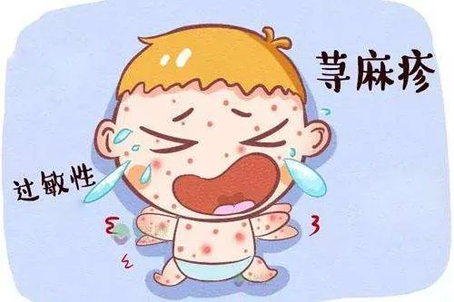 荨麻疹科普小常识