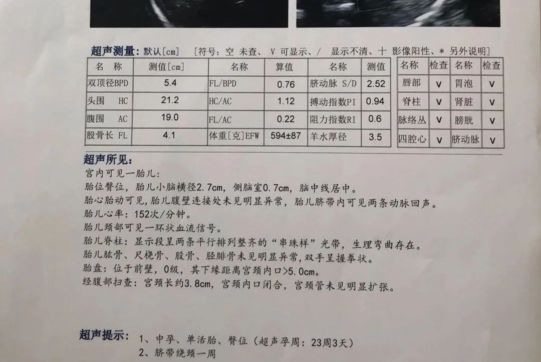 孕期要做多少次B超，如何看B超单？