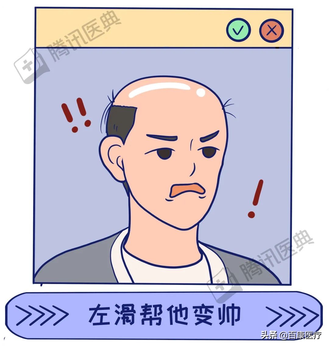 90后小伙竟秃成了50岁大叔丨脱发，如何自救？
