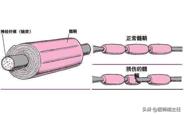 甲钴胺不仅能修复受损神经，还能用于这5种常见病的治疗，好用