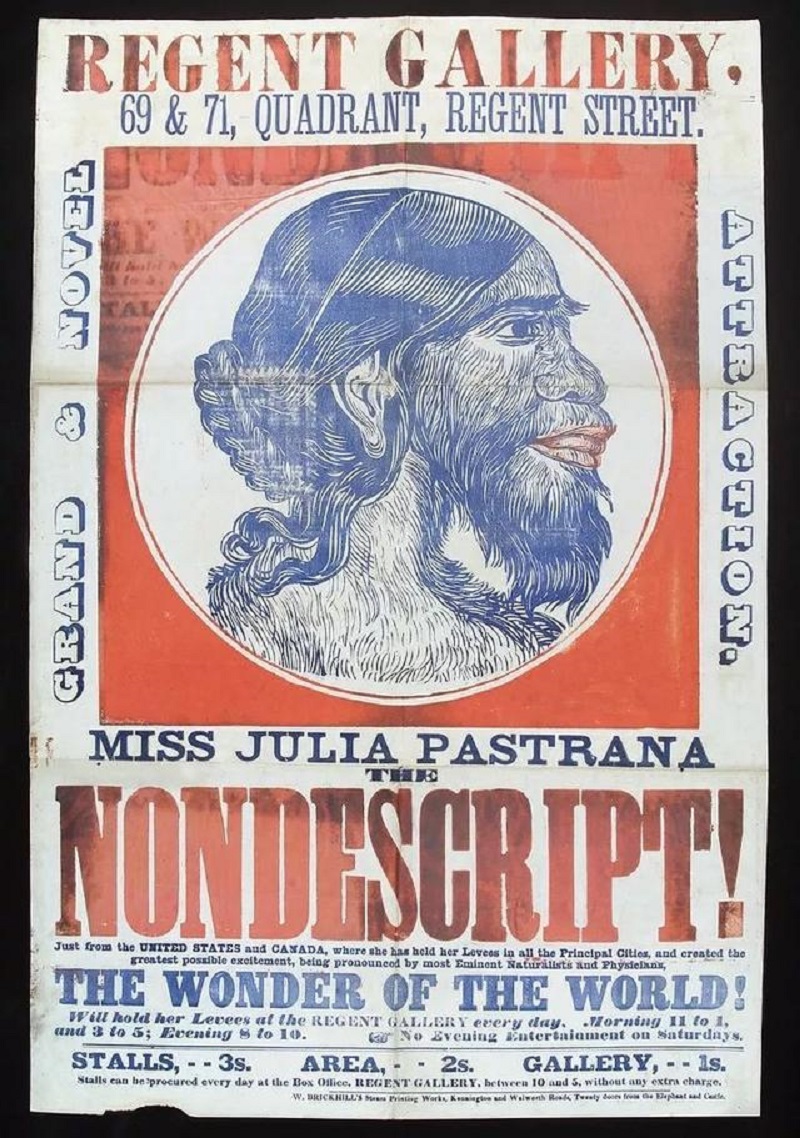 她被称为最丑女人，一生因奇特长相被当摇钱树