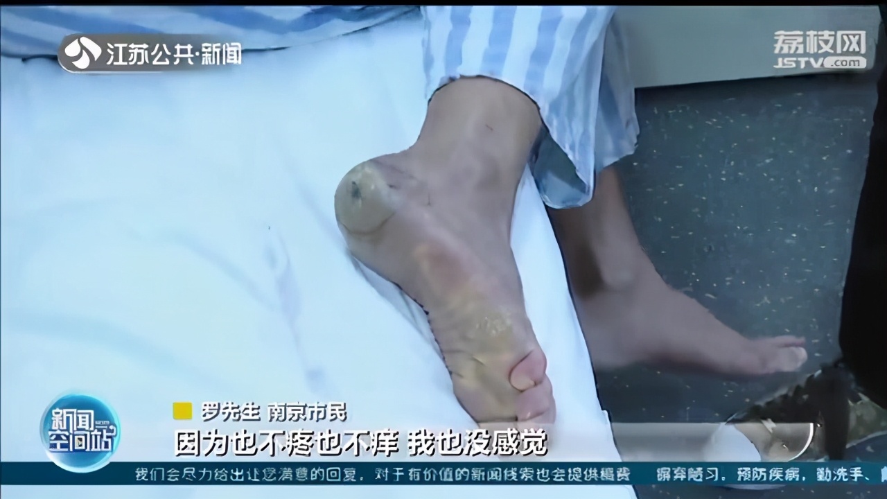 &ldquo;痣&rdquo;命危机！警惕一颗小痣变成癌症