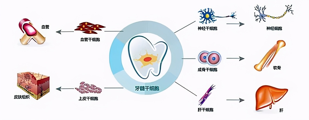 小细胞大作用：牙髓干细胞治疗银屑病即将成药上市