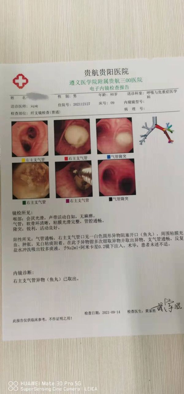 危急！82岁老年患者被“鱼丸”卡住