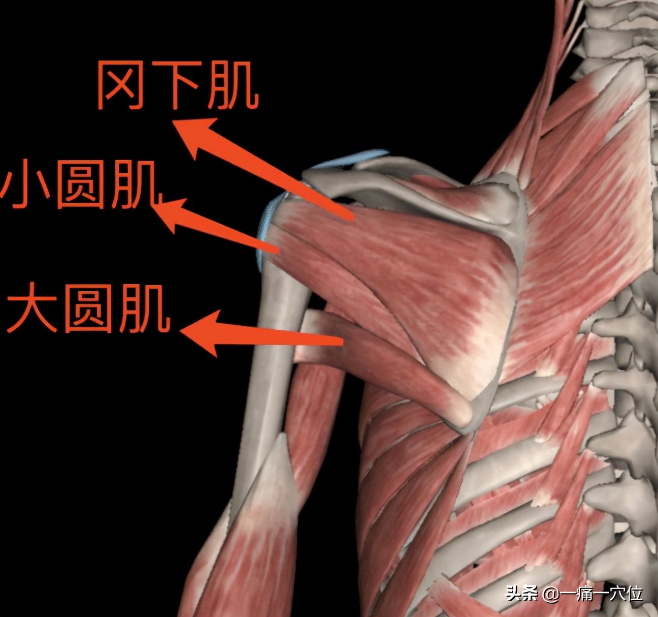 Frozen shoulder, pain in the back of the shoulder, many times have no