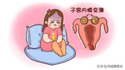 「免疫相关不良妊娠答疑解惑50」——中医中药