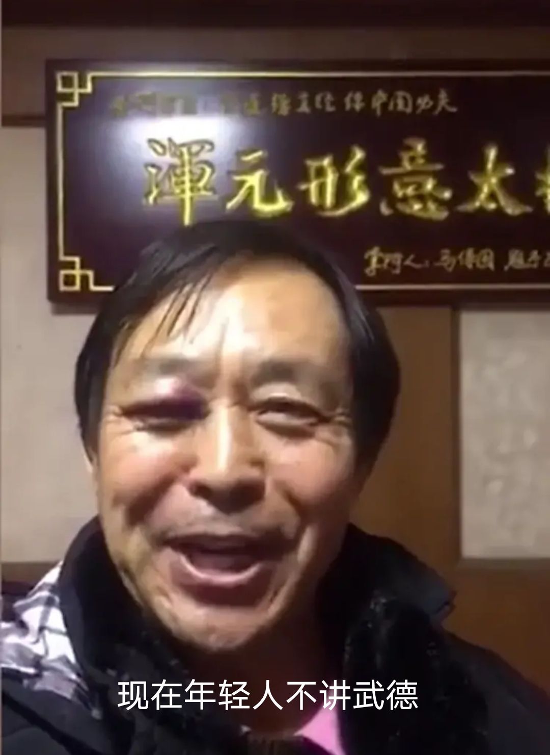 马保国鼻青脸肿还自夸，称自己点到为止，对方无武德偷袭69岁老人
