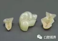 牙隐裂知多少？