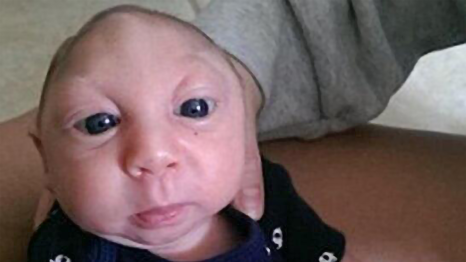 Brain Less Baby Severely polluted cities: 35% of babies live less than one year old ...