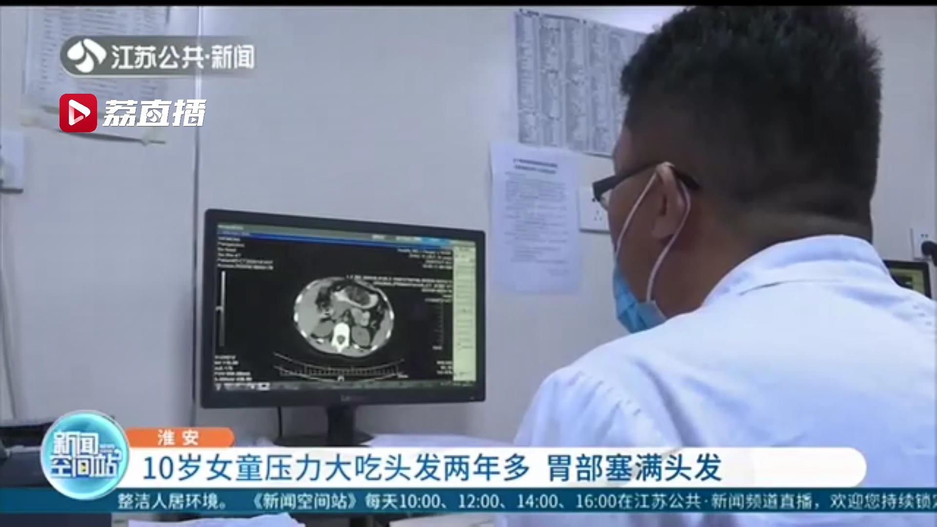 头发@两年多来胃部被塞满 关注儿童健康！10岁女童压力大吃头发
