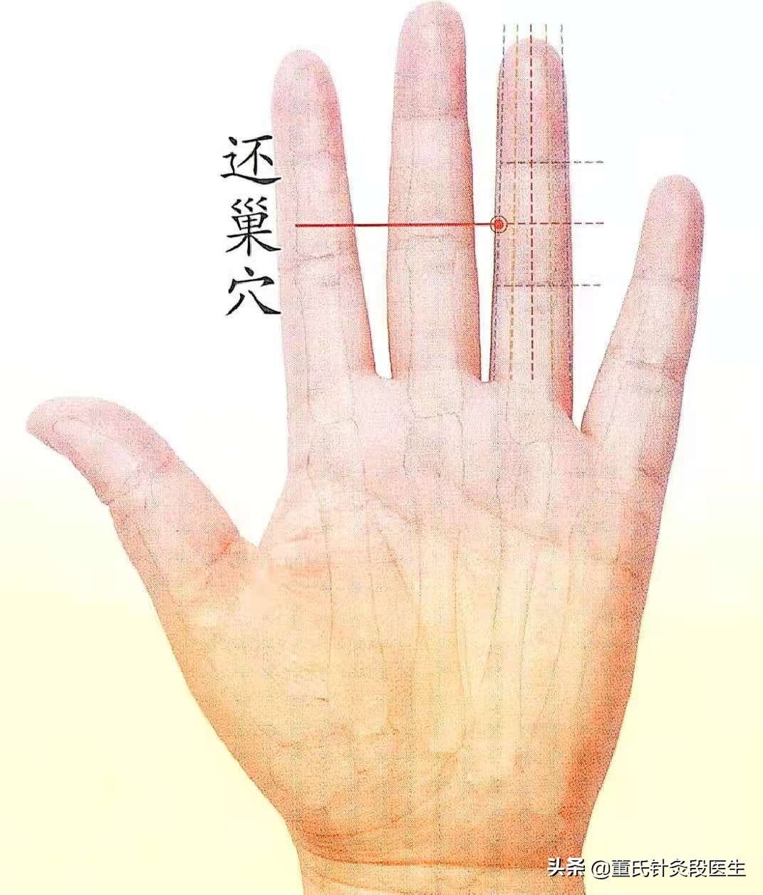 Dong's acupuncture and moxibustion return to the nest, the big acupoint