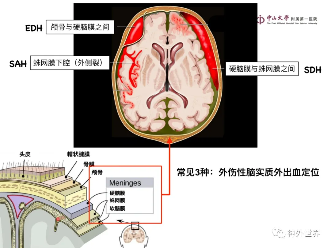 最全影像总结 | 颅内病变 MR、CT 的阅片技巧，太赞了