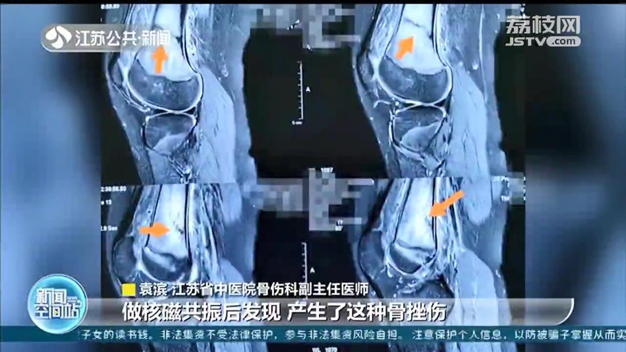 “双减”之后，孩子科学运动有讲究 专家：切勿从“基本不动”变“高强度运动”