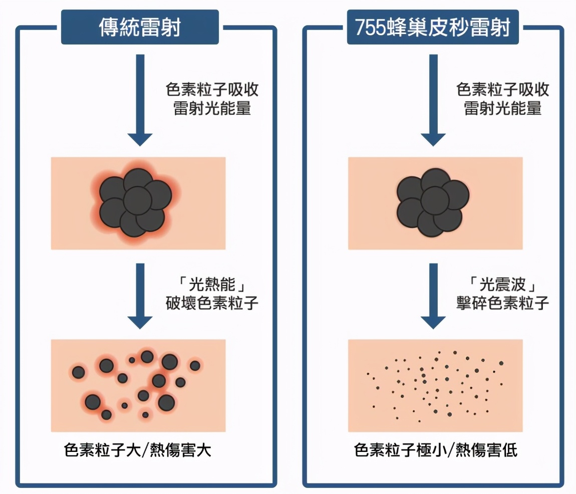 范冰冰带火的picosure 755蜂巢皮秒 到底是什么 资讯咖