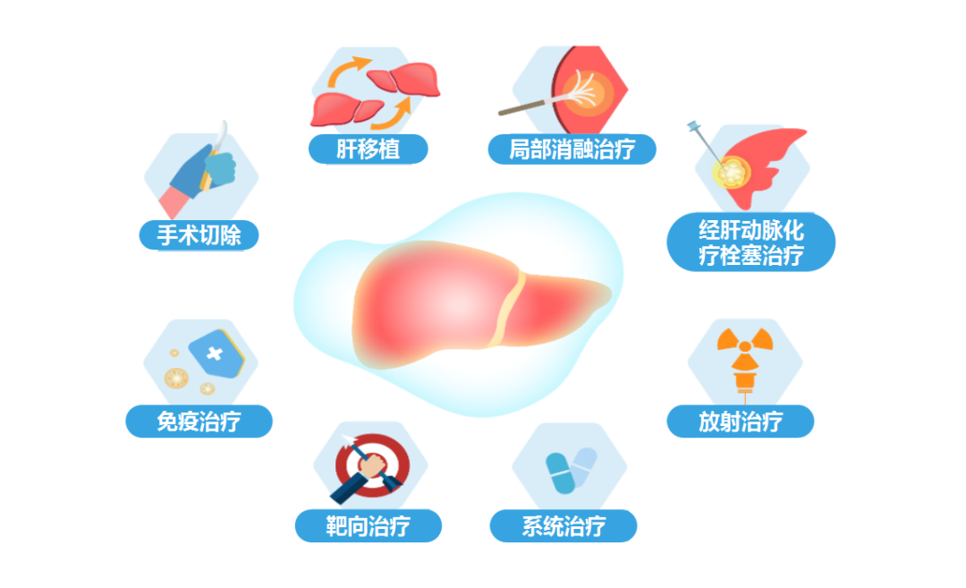 原发性肝癌患者指南系列解读（第二期）-治疗篇圆满落幕