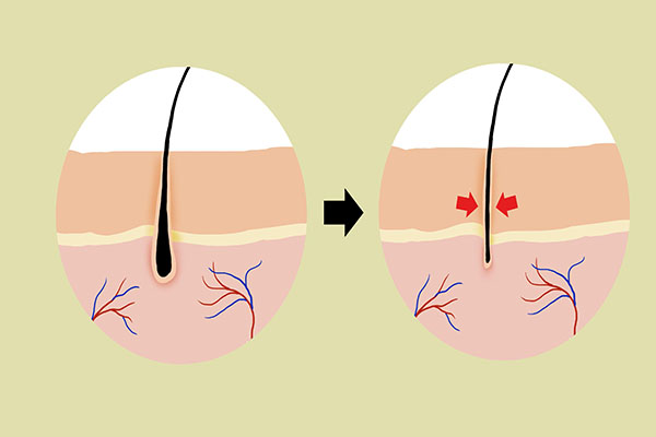 头发太长会吸走人体营养吗？脱发与头发长短有没有关系？