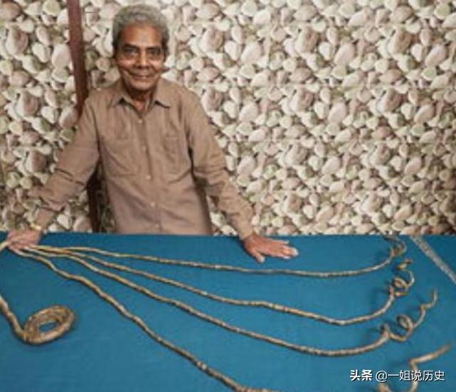 An Indian Man Kept His Fingernails For 44 Years. After Donating His 9 