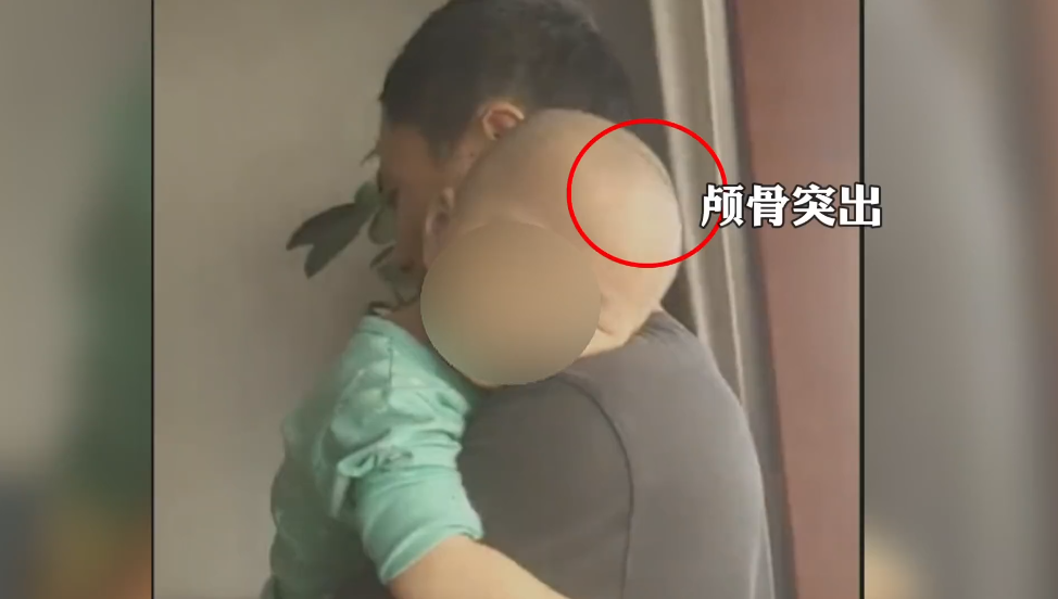 湖南人注意！郴州出现多个“大头娃娃”！均为