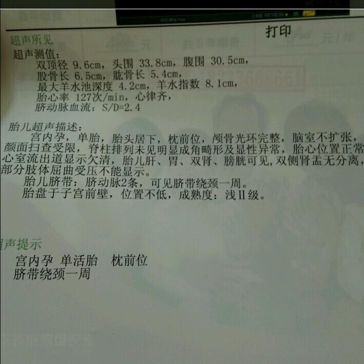 什么是双顶径？用双顶径预估胎儿的体重准确吗？这些影响孕妇须知