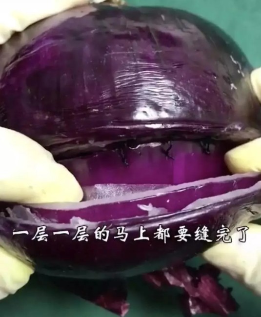 應采兒二胎剖腹產過程曝光：永遠不要低估一個生孩子的女人