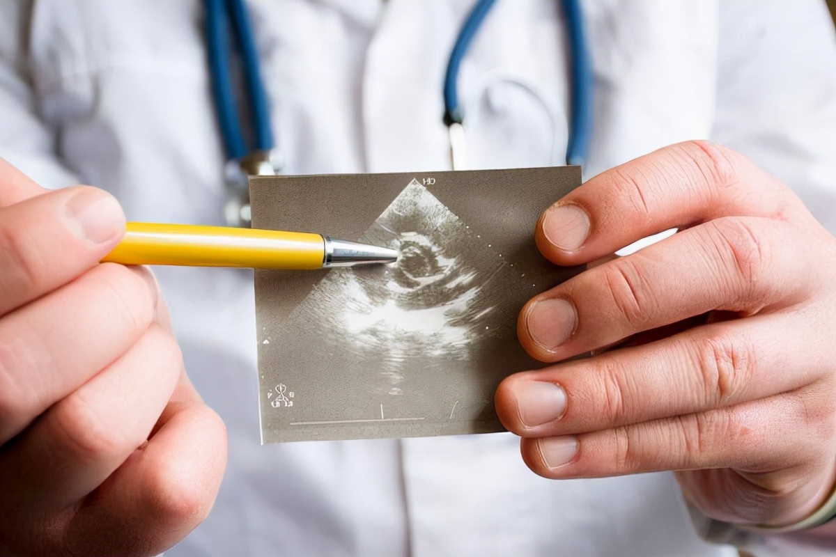 b超对胎儿有影响吗？孕期做多少次才合适？