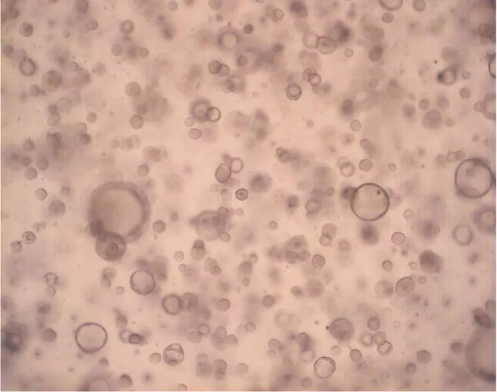 90�����Ů���з��������⻹ԭ���ٷ������ɹ���Ϊ90%