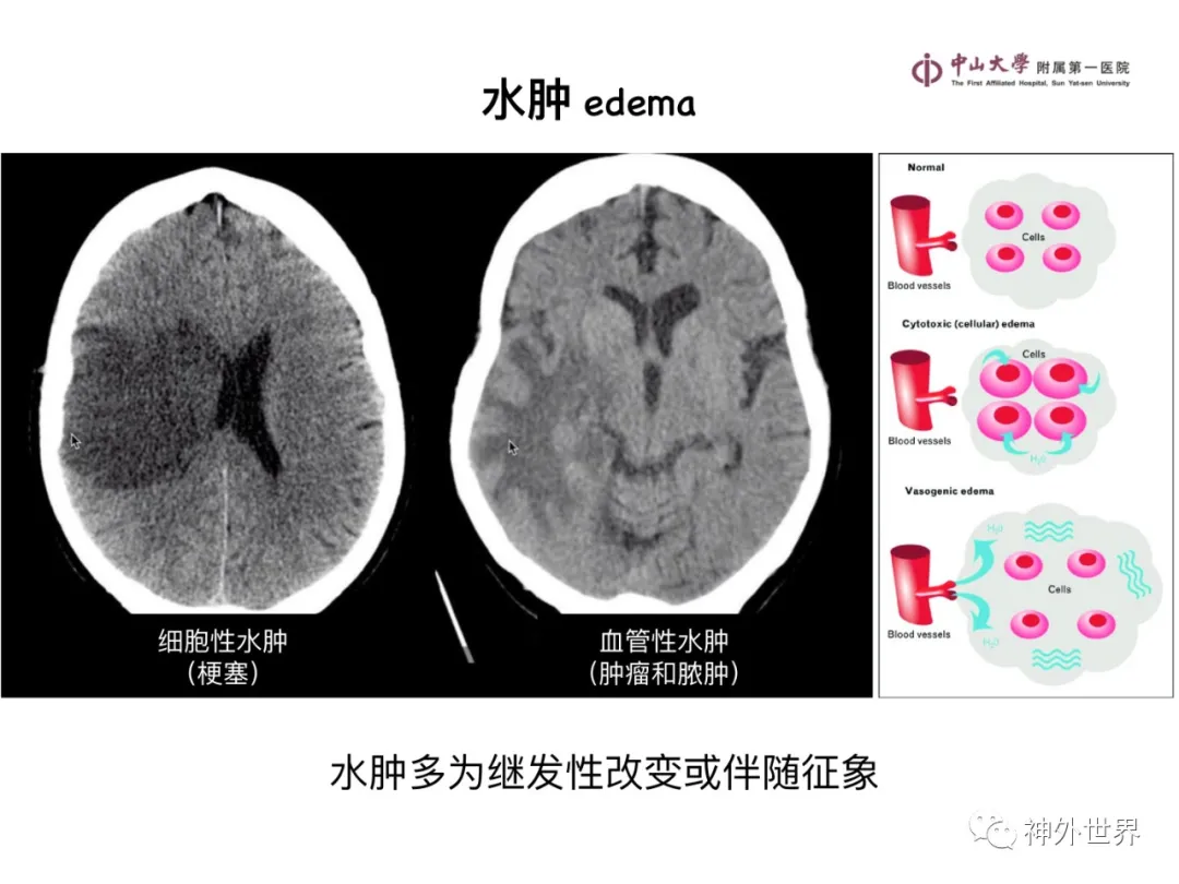 最全影像总结 | 颅内病变 MR、CT 的阅片技巧，太赞了