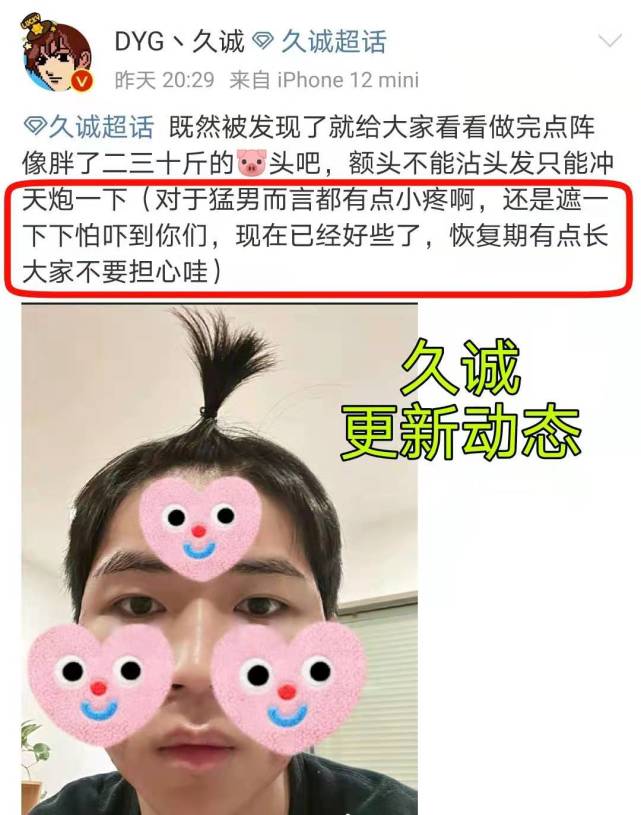 LGD of DYG sweep anything away is become gain the championship popular! Long sincere hair " the individual is dynamic " , 