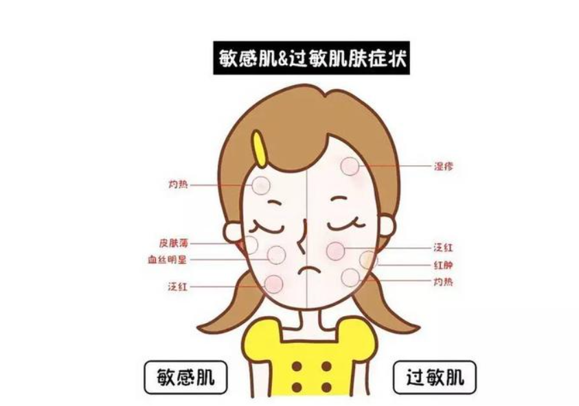 敏感肌如何护肤？避开误区、找对方法，才能事半功倍