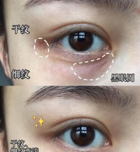 戚薇晒出屈臣氏“镇店之宝”，吴昕同款！李佳琦：细纹眼袋消失了