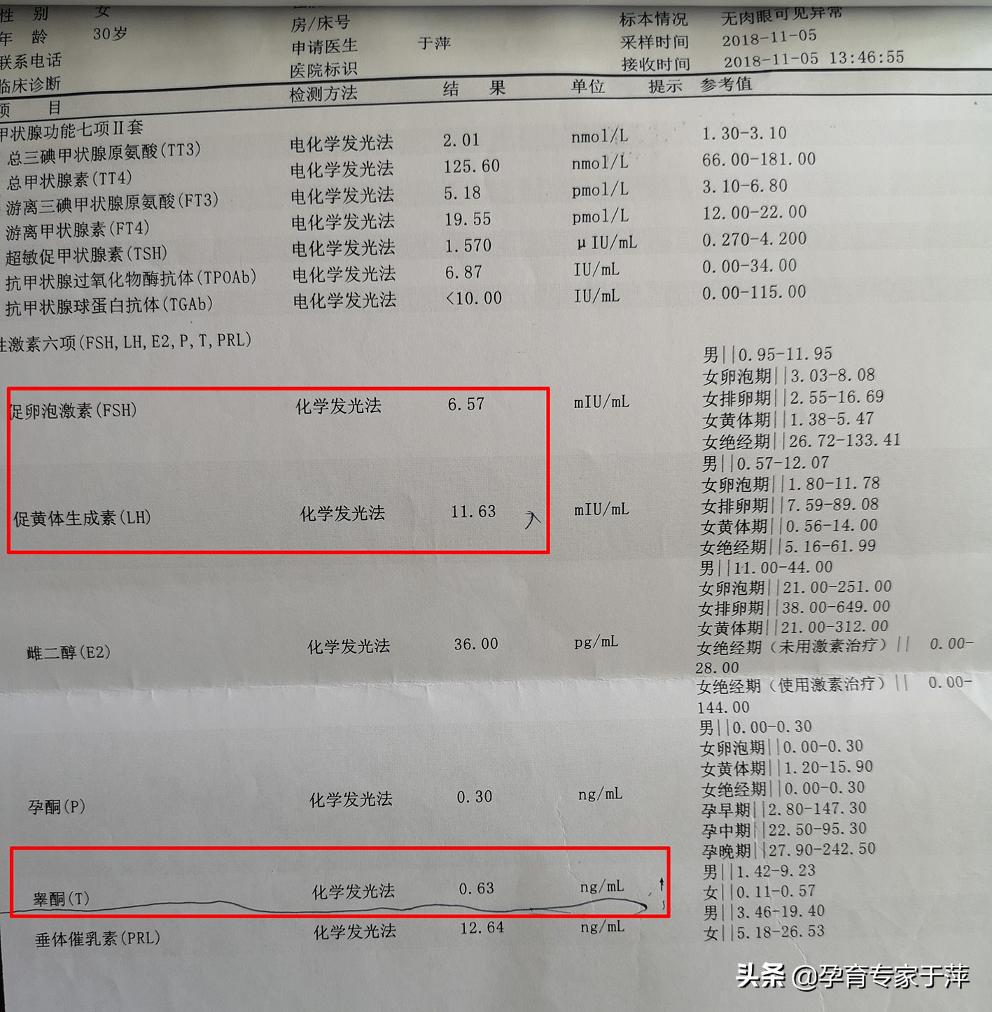 青岛市促孕权威专家于萍：多囊卵巢综合征，到底是种什么病？
