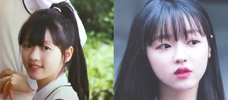 YooA 回应对自己的整形争议;防弹不出演打歌也包揽一位?