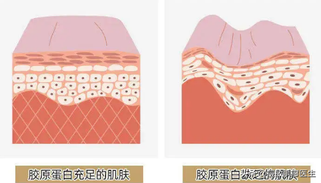 热玛吉科普，了解清楚再做也不迟