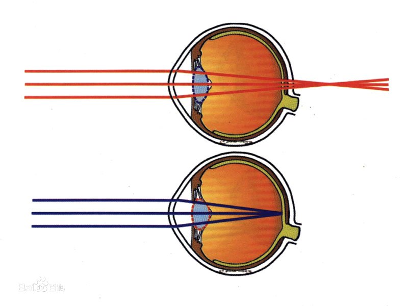 Refraction System Recruitment physical examination ophthalmology popular science: diopter ...