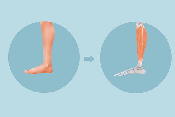 哪些原因会造成腿抽筋？该如何缓解？