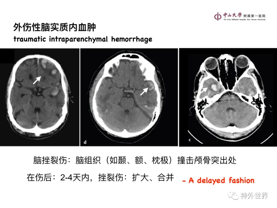 最全影像总结 | 颅内病变 MR、CT 的阅片技巧，太赞了