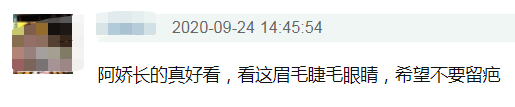 阿娇首晒伤口照！疤痕触目惊心却不影响美貌，变高低眼也是美人