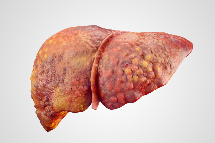 春季养肝正当时，肝不好的人，身体可能有10个症状，对照自查