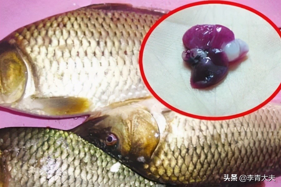 為“敗火”生吃一個魚膽，結果被血透