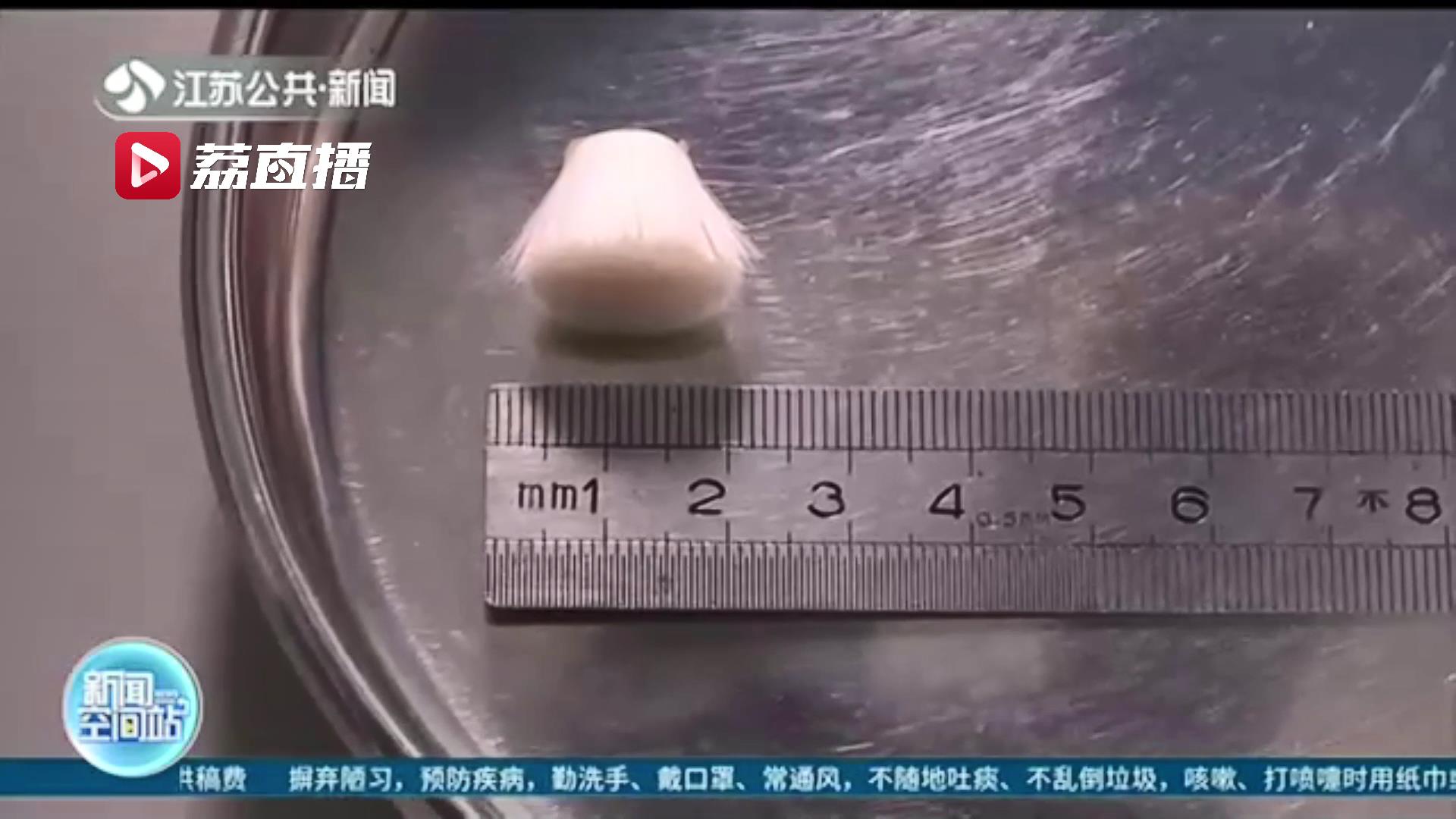 两岁男童使用电动牙刷误吞刷头 医生提醒：五岁前慎用