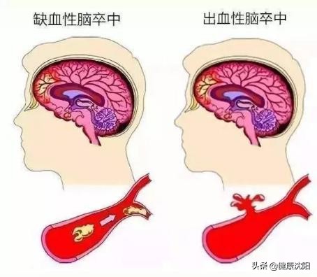 健康知识普及行动系列科普知识讲座之重大疾病篇