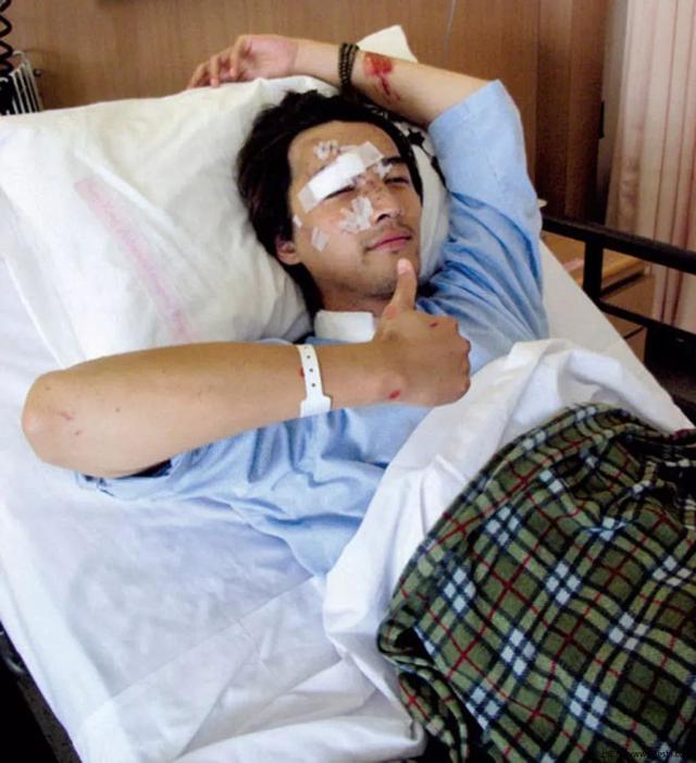 Hu Ge's Ups And Downs!Disfigured In A Car Accident At The Peak Of His ...