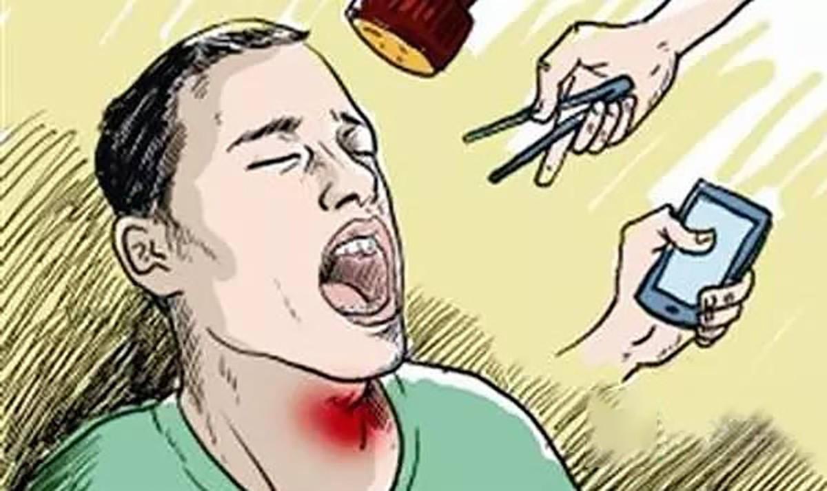 The fish bone stuck in the throat. The guy died 3 days later. Doctor