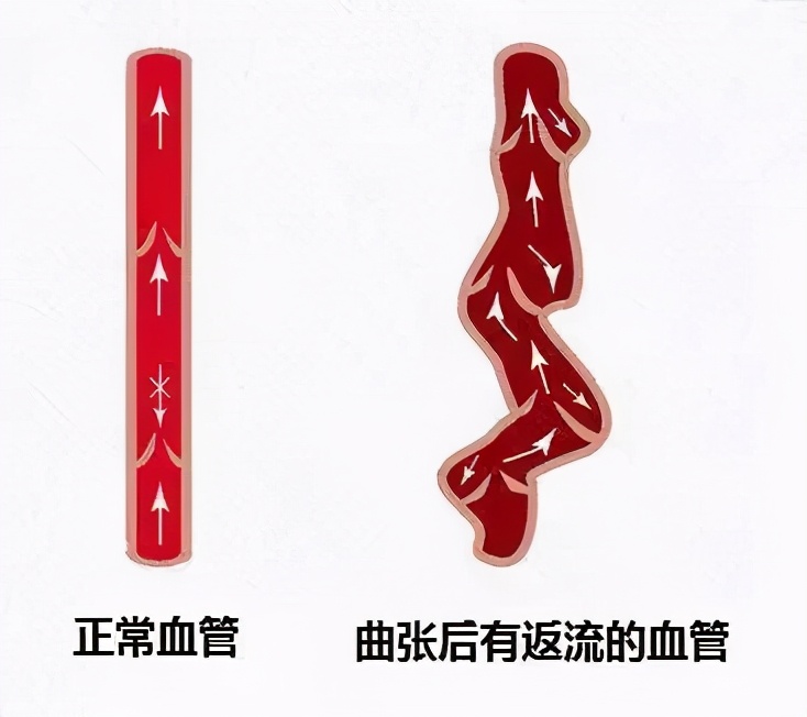 它会导致不育和X功能障碍，十个男的就有一个会得