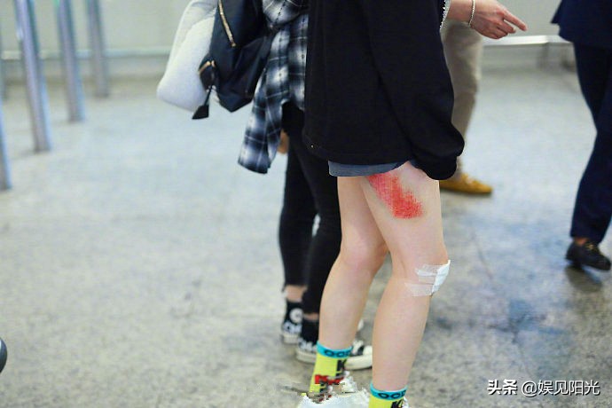 黄龄跌落受伤，主办方和承建方回应的原因不一致，动图一目了然