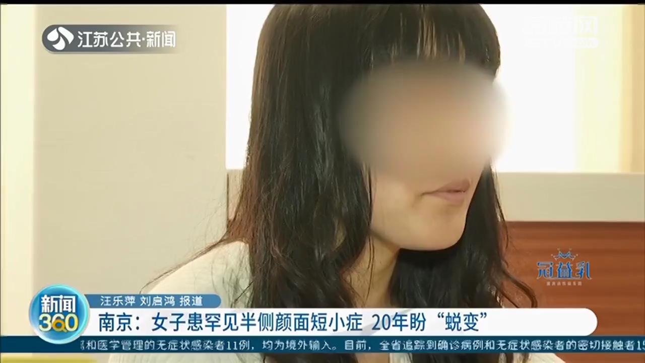 两边脸不对称，罕见半侧颜面短小症 南京女子20年两次手术盼“蜕变”