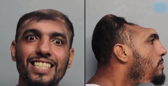 原本只是涉嫌教唆卖淫，却因具有独特生理特征而红遍全球