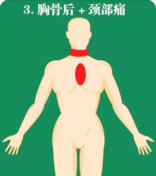 11.20心梗救治日丨咸阳市第一人民医院在行动