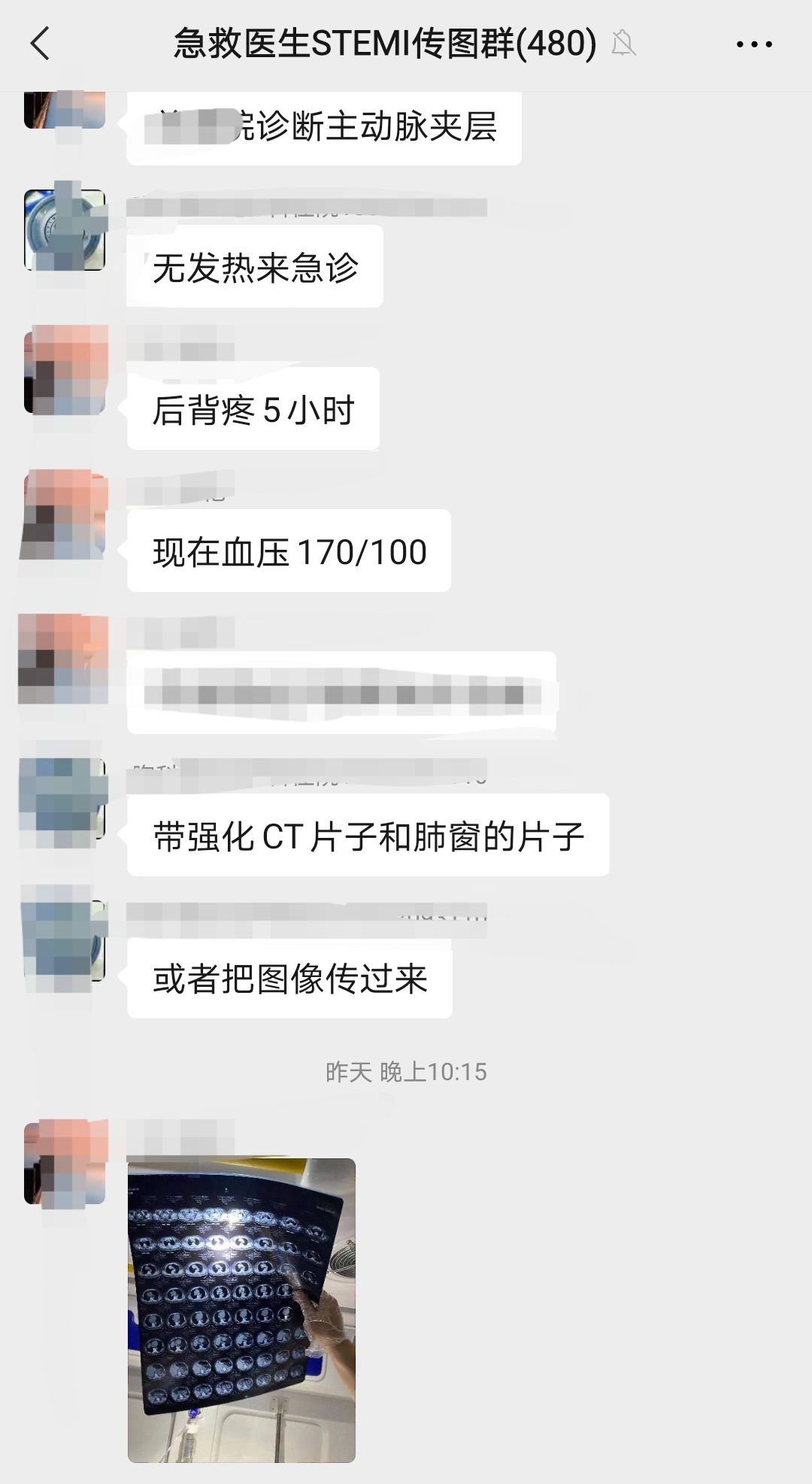 51岁男子后背疼痛5个小时，最大血管破裂！直接原因就是高血压