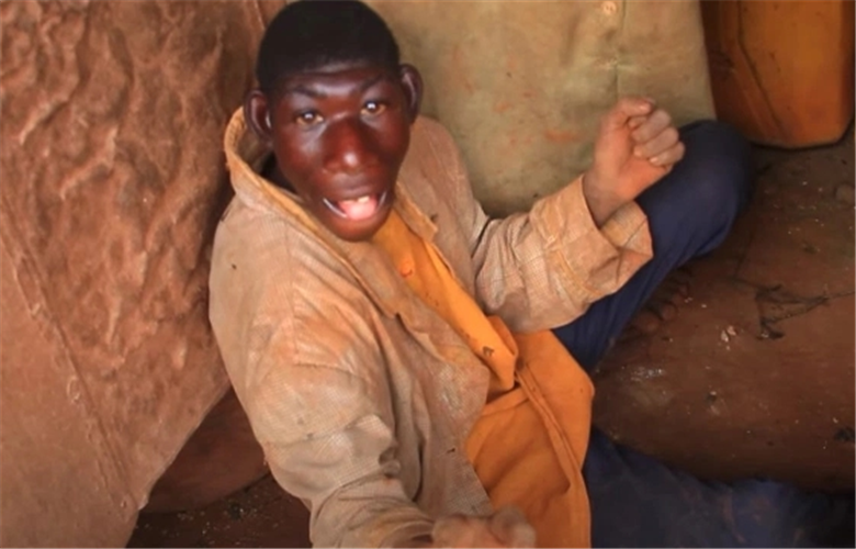非洲男孩因长相酷似“猿类”，遭村民戏弄，被逼爬树、逃跑